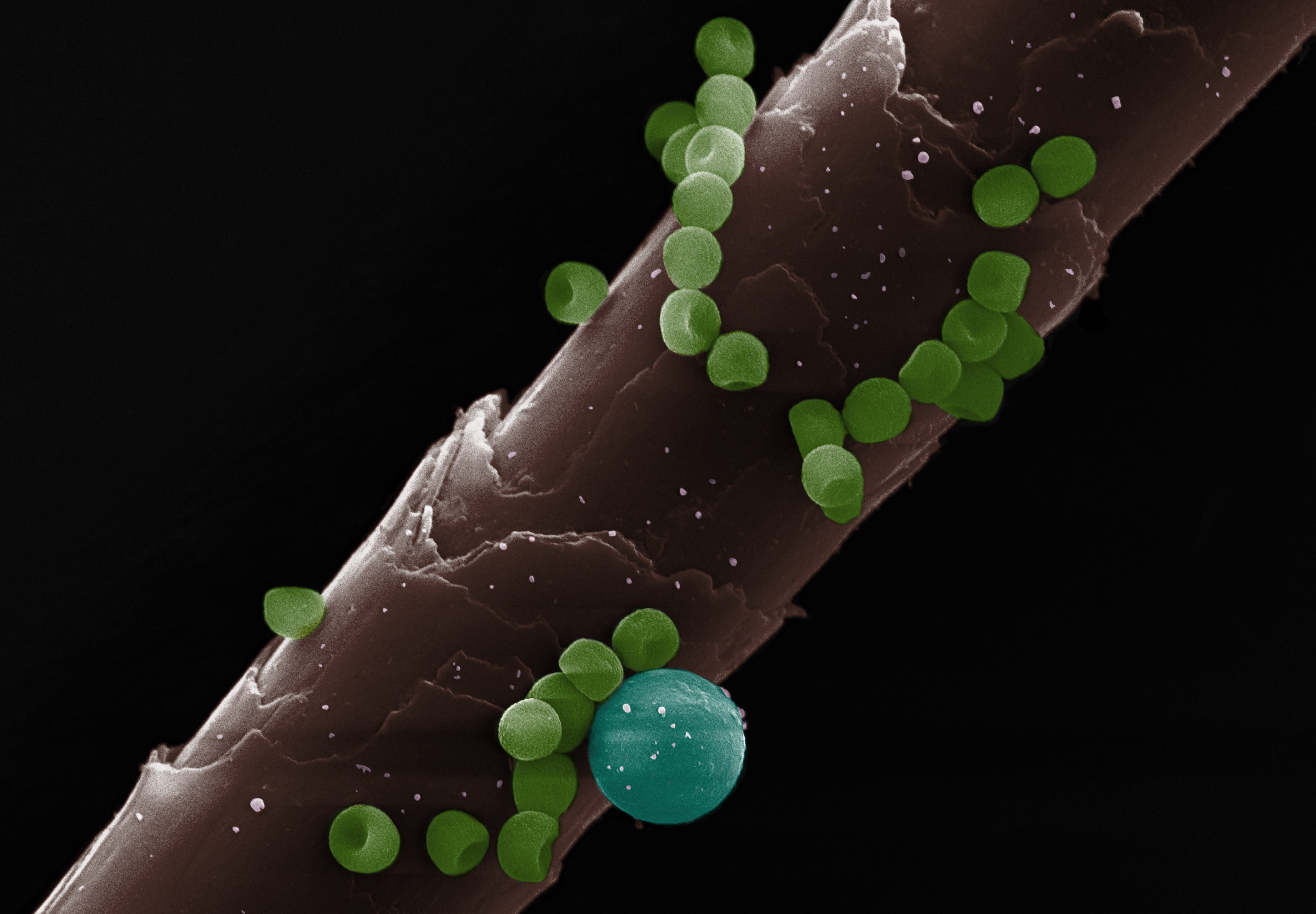 Fukt og muggsopp kan gi helseplager. Mangel på utluftning kan være årsaken til problemet.